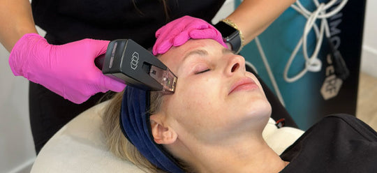 AccuTite vs. Morpheus8: Which is best for Skin Tightening