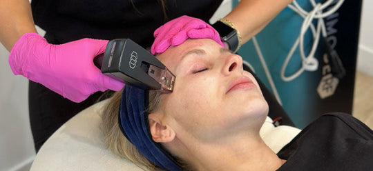 AccuTite vs. Morpheus8: Which is best for Skin Tightening