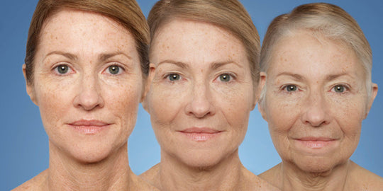 Facial Fat Loss & Aging: Top Treatments in Calgary