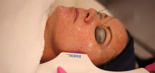 The Most Effective Skin Laser Treatments for Different Skin Conditions