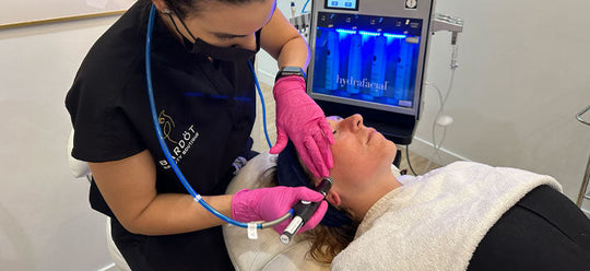 best treatments for blackheads in calgary