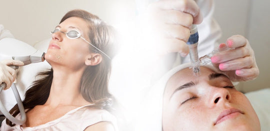 laser facials vs microneedling for improving skin