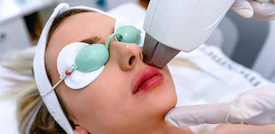 woman getting laser skin care
