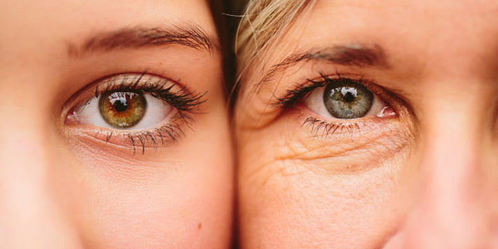 sculptra pros and cons