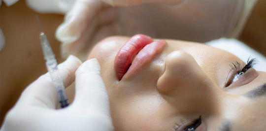 things to know about dermal fillers