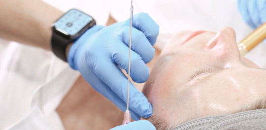 woman getting thread lift face lift