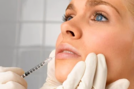 Dermal filler injection treatment to restore facial volume and contour