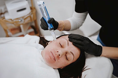 Microneedling treatment to support collagen production and improve skin texture
