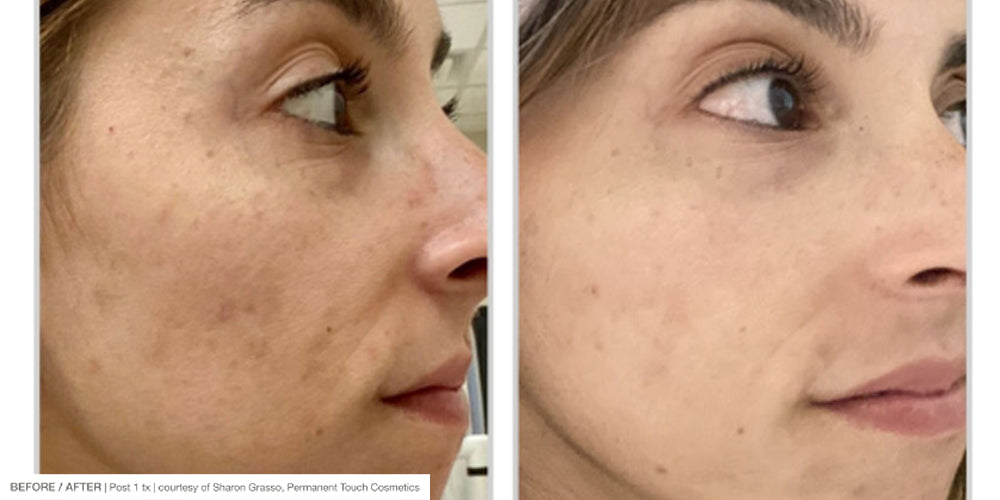 Before and after treatment imagery